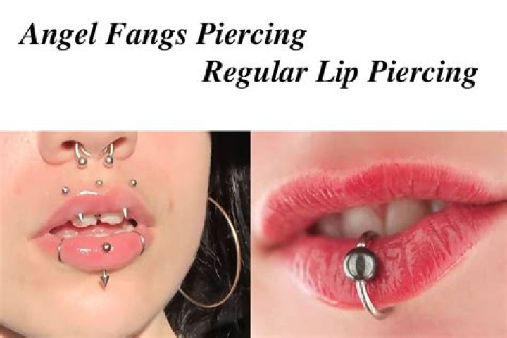 Angel Fangs Vs Angel Bites Explained