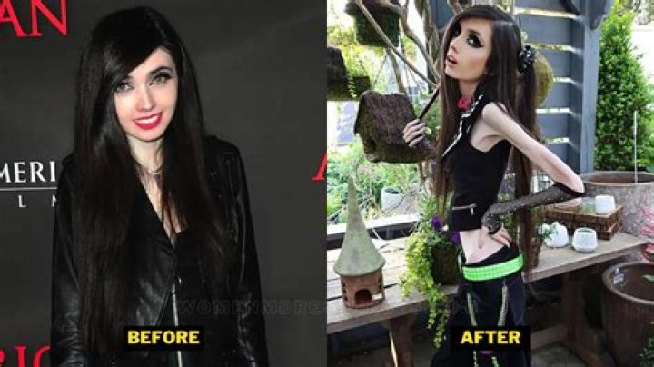 Eugenia Cooney: Before And After