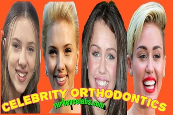 The Best Celeb Tooth Transformations