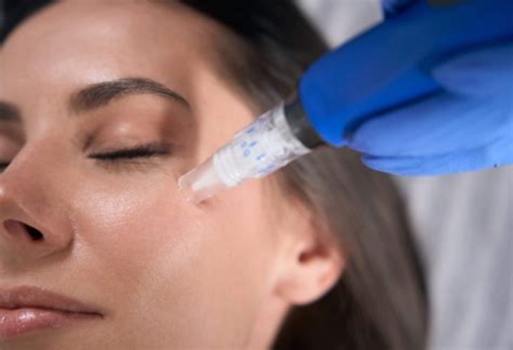 Unlock Radiant Skin With Kylie Rocket