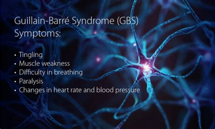 Unlocking Insights And Potential Therapies For Guillain-Barr Syndrome