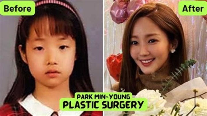 Unveiling Park Min Young's Transformation: Surprising Insights Pre-Plastic Surgery