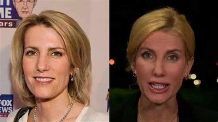 Unveiling The Secrets Of Laura Ingraham's Plastic Surgery Journey